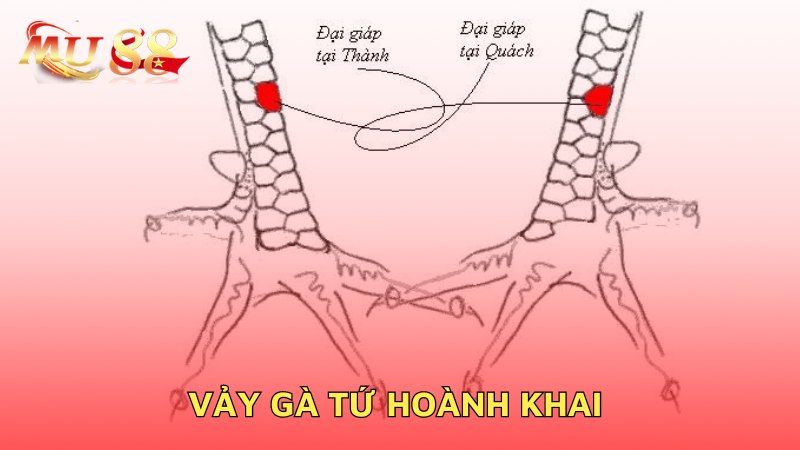 Vảy gà tứ hoành khai 